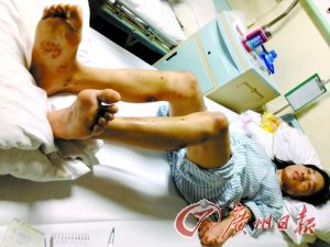 东莞女子被怀疑不忠 遭男友虐待两昼夜